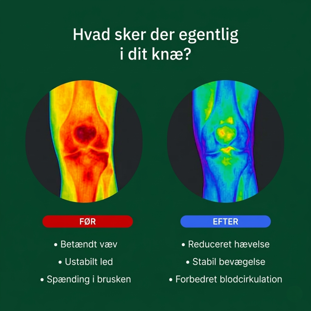 Nuvori - Knæstøtte